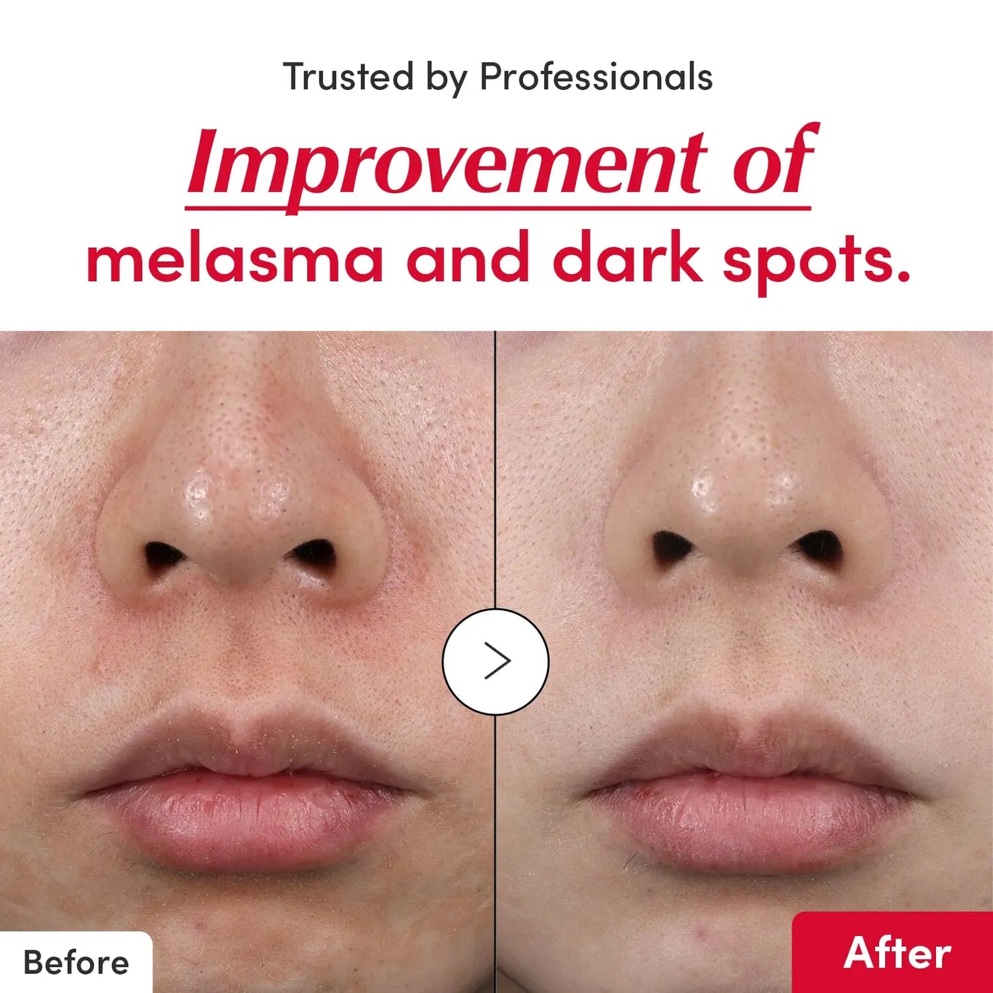 Vitamin Iluminating Serum 30mL – EQQUALBERRY