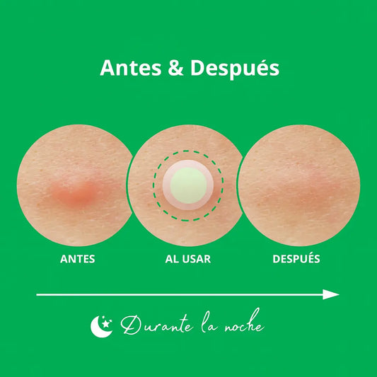 Spot Eraser Green – NOLAHOUR