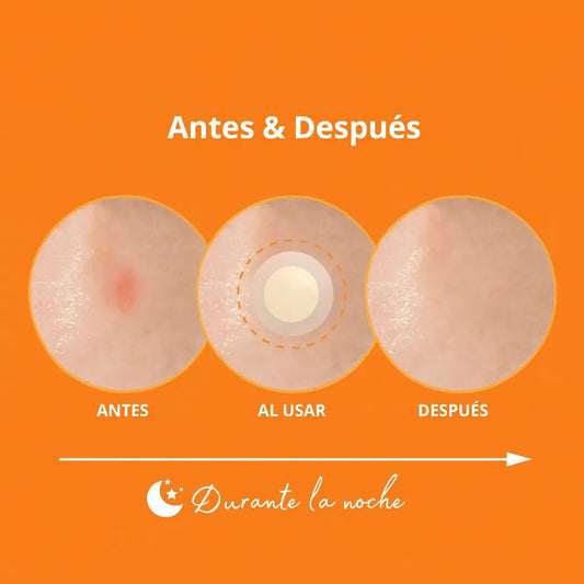 Nolahour Parche Spot Eraser Orange – Red Spot