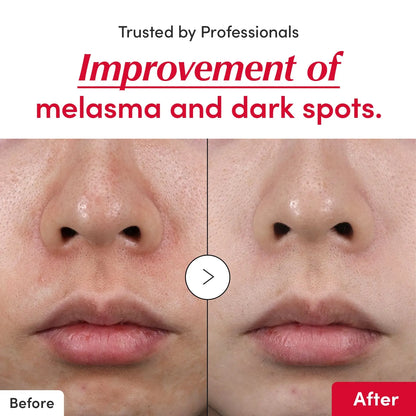 Vitamin Iluminating Serum 30mL – EQQUALBERRY